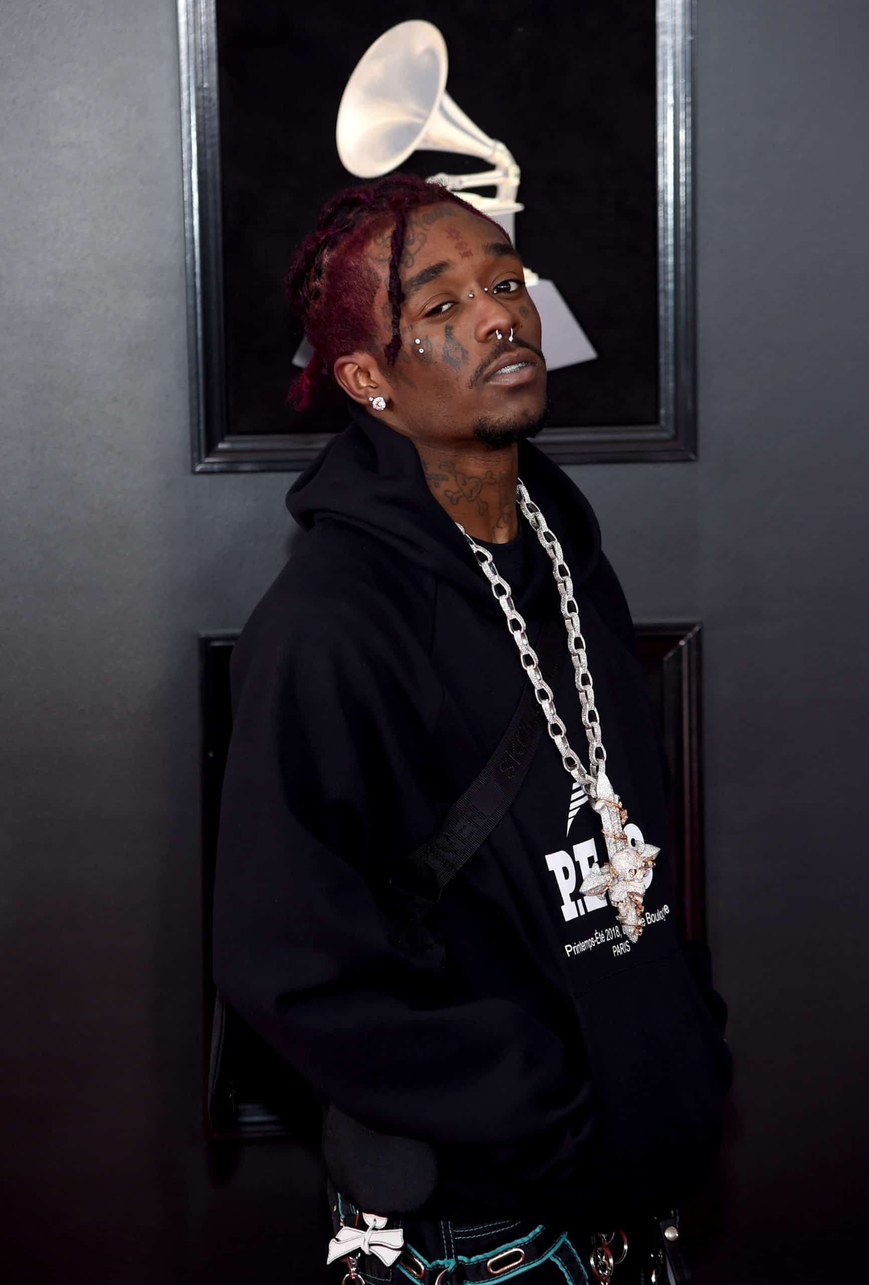Lil Uzi says he paid millions to have Pink Diamond implanted in his forehead.  Walka sauce answers