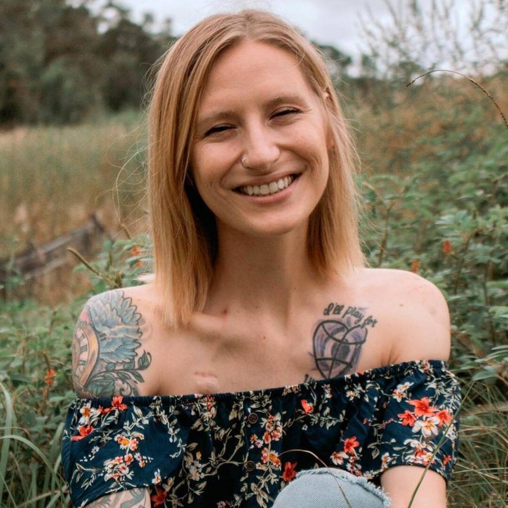 Health Mannequin & Influencer Cheyann Shaw Lifeless At 28 After Most Cancers Battle • MV TELEGRAPH - Vimarsana News