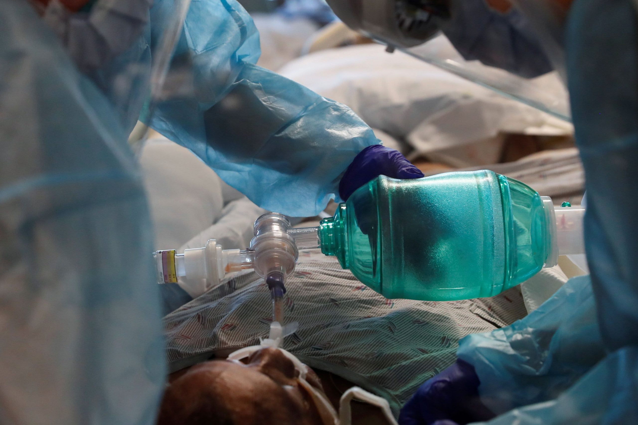 Medical experts are trying to make a "long Covid" diagnosis for patients with persistent symptoms