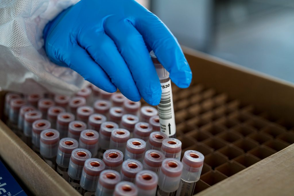Researchers Establish 5 New Circumstances Of Variants In California • MV TELEGRAPH - Vimarsana News