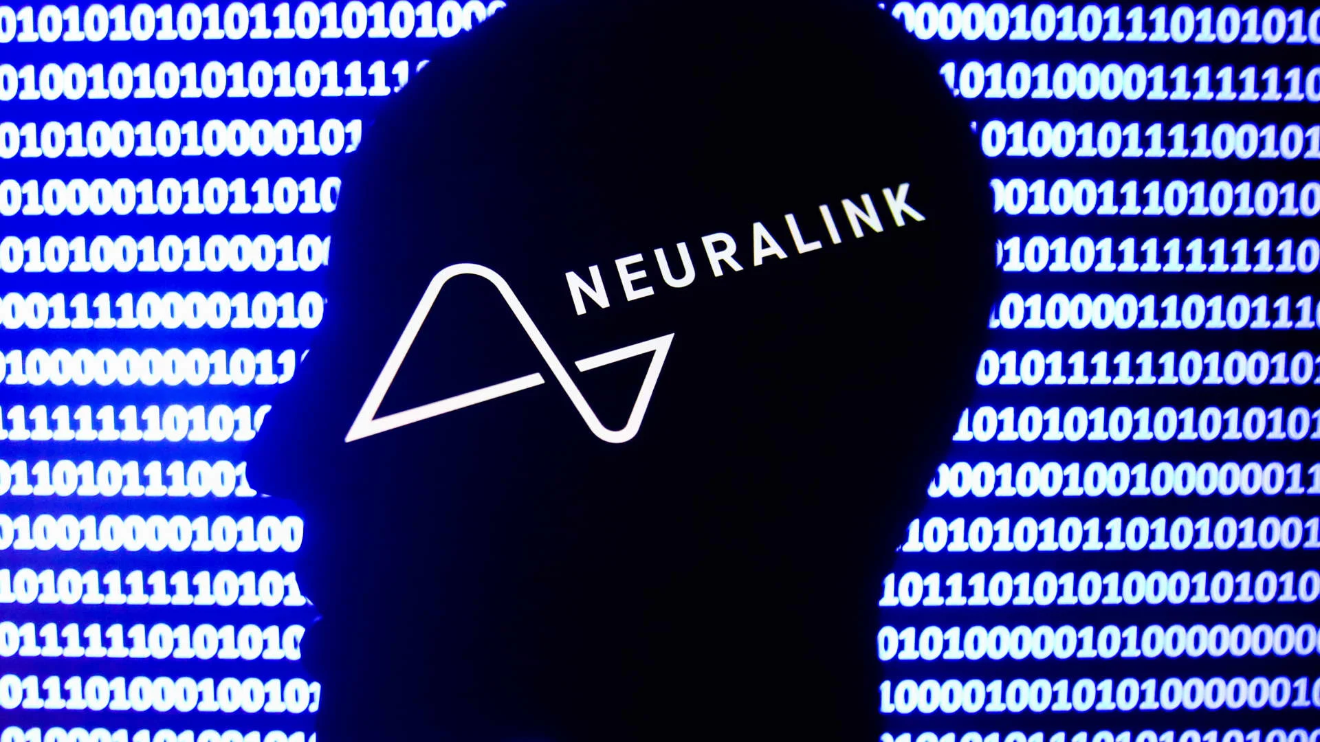 Musk says he'll put a Neuralink chip in his brain when they're ready