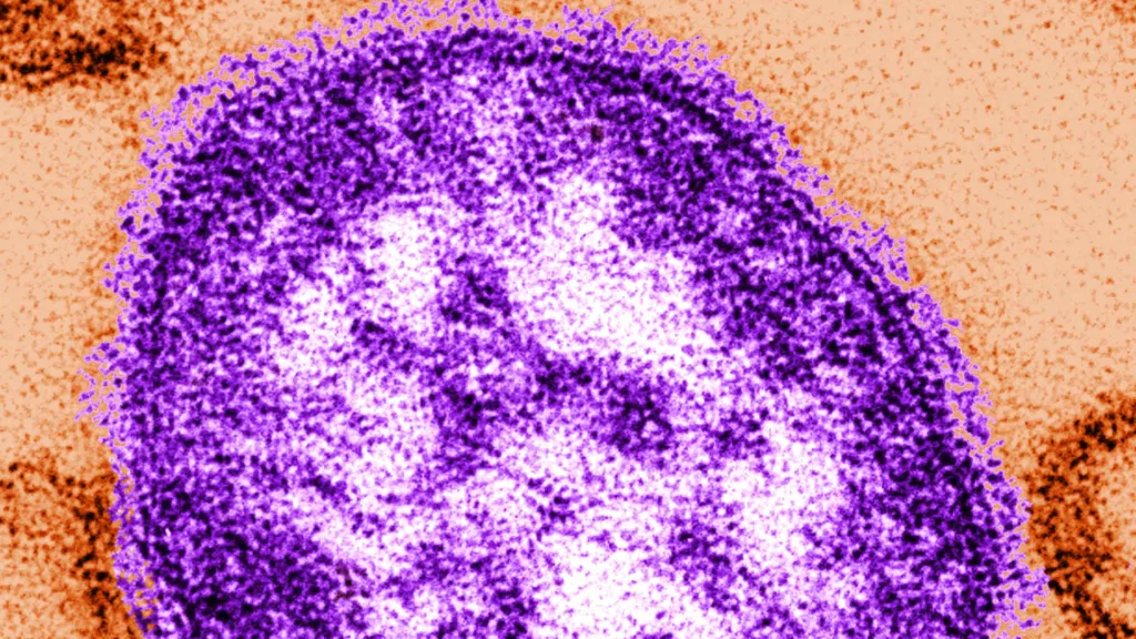 250,000 Kindergarten Youngsters Are In Danger As A Result Of Falling Vaccination Charges • MV TELEGRAPH - Vimarsana News