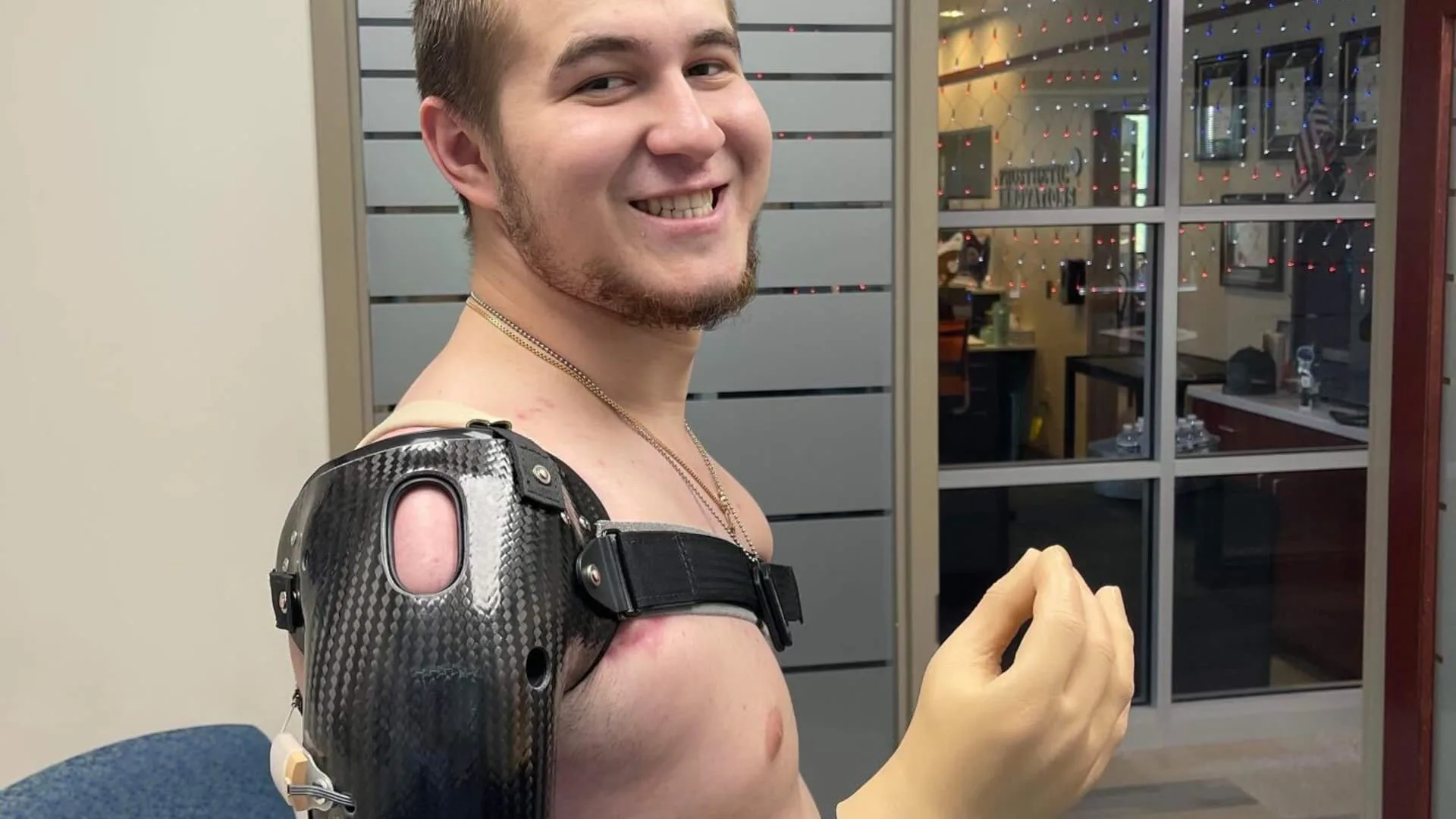 Wounded soldier reflects on his recovery