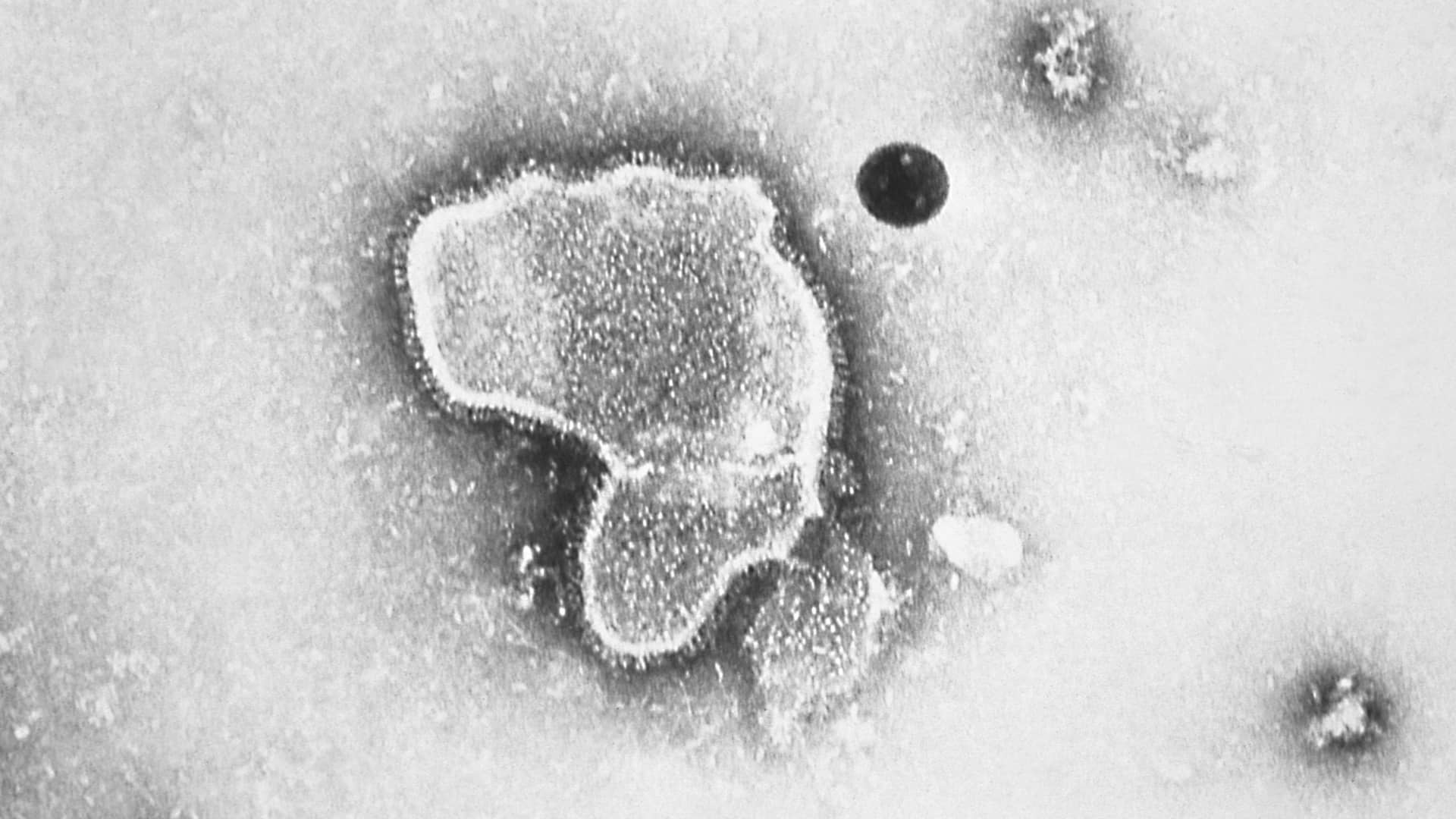 FDA says Guillain-Barre syndrome is a potential risk for a Pfizer RSV vaccine