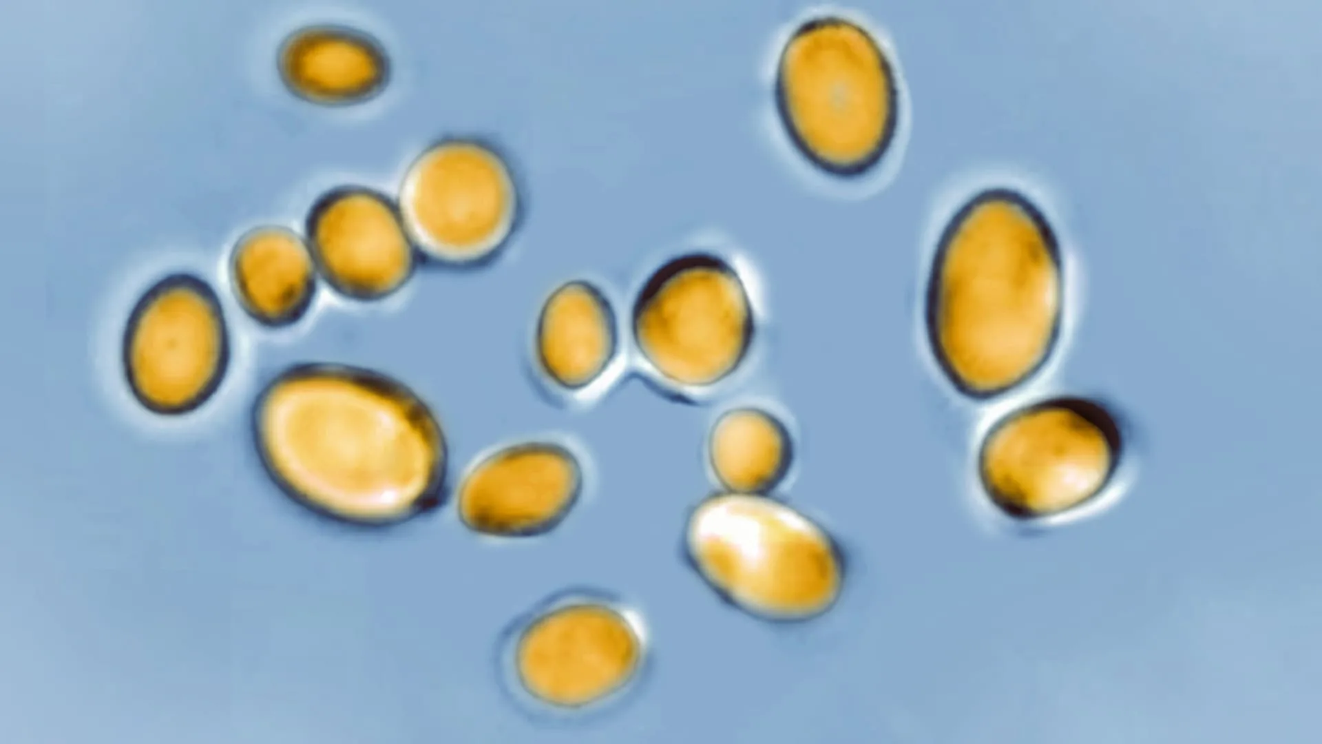 Fungal drug resistance is spreading fast, CDC says